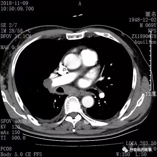 怎么应用统计学做调查,统计学方法可以解决的主要问题