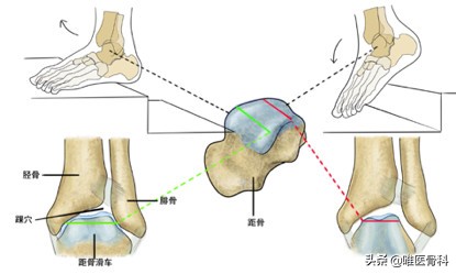 医生处理崴脚的全过程,崴脚后最专业的处理