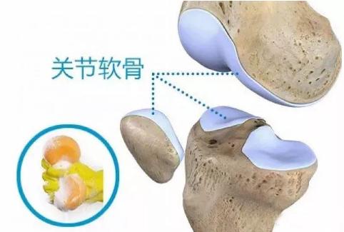 骨质增生和骨关节炎补钙有用吗,骨刺骨质增生关节炎用什么药