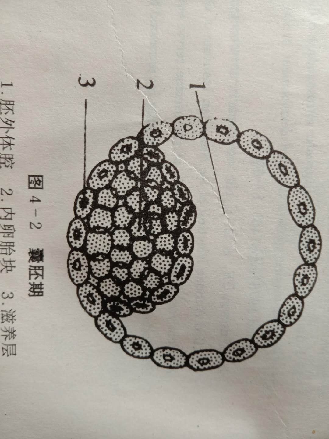 药物流产得多长时间才能流下来,药物流产后怎么判断是否流干净