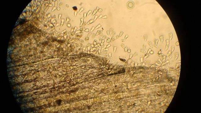 斑节对虾养殖过程中纤毛虫的危害,青蟹纤毛虫病图片及防治