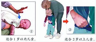 幼儿吞食不光滑异物该怎么办,宝宝吞食异物的处理办法