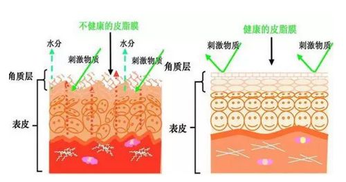冬天面部角质层薄起皮泛红,换季敏感皮肤泛红脱皮怎么办