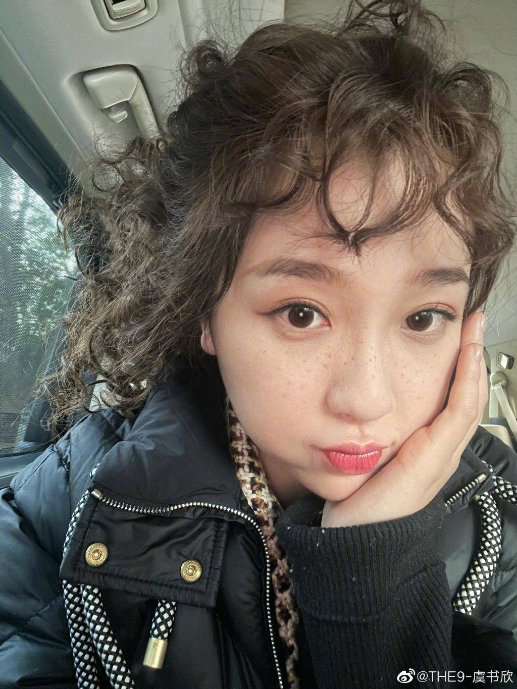 严重泪沟黑眼圈,淡化黑眼圈和泪沟原理