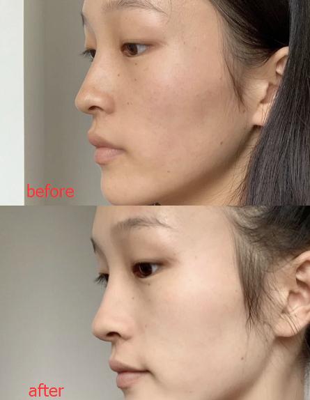 去黄提亮紧致茶面膜,韩国茶树面膜