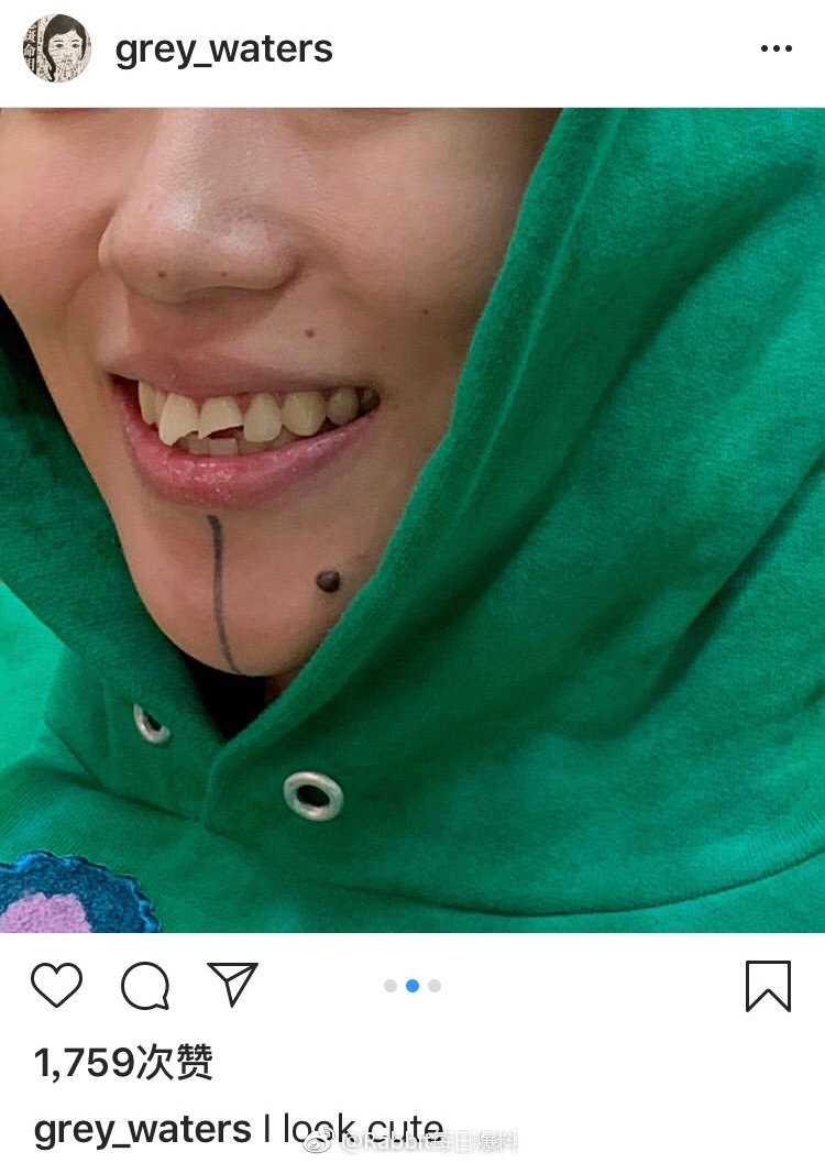 窦靖童门牙笑容灿烂,窦靖童磕破门牙