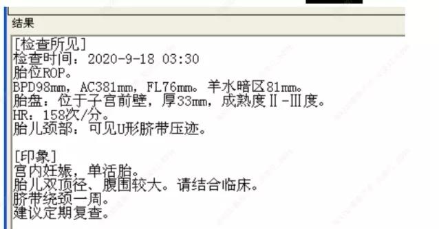 准妈妈对宝宝说的话,准妈妈的技巧和方法
