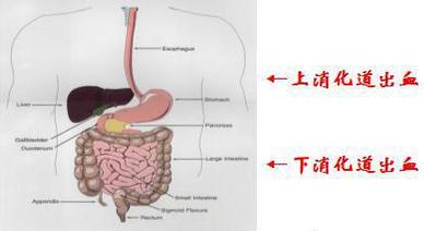 健康宣教对消化道出血病人的意义,消化道出血患者健康教育