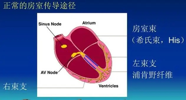 孕妇心动过速外加有点心肌缺血,怀孕心电图窦性心动过速心慌胸闷