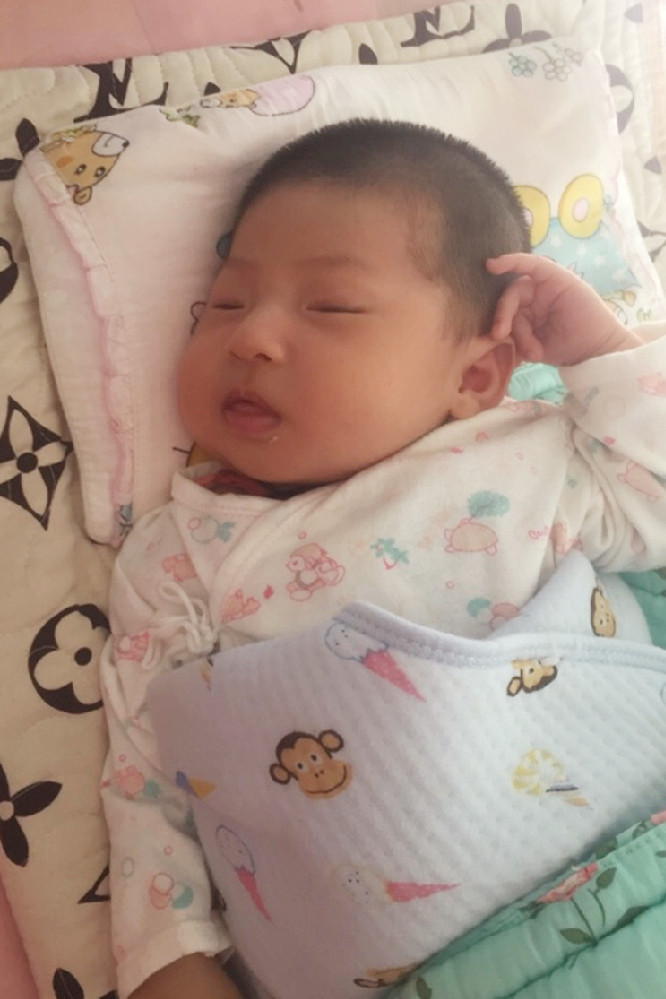 纠正宝宝偏头睡觉的小妙招,如何防止宝宝睡偏头及补救方法