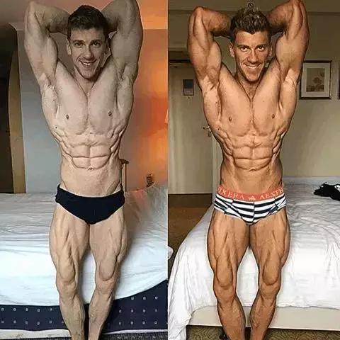 26岁健美冠军小腿静脉爆裂,22岁小伙健身过猛导致内脏撕裂