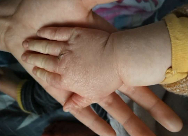 宝宝皮肤粗糙像砂纸怎么办,宝宝四肢粗糙颗粒状怎么回事