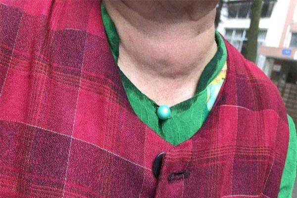 有甲状腺疾病能不能吃含碘食物,为什么要吃碘来预防甲状腺疾病