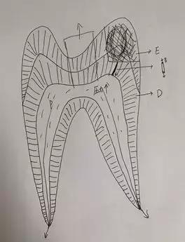 牙痛怎么办教你一招解决牙疼,牙痛怎么办有三种方法治牙痛