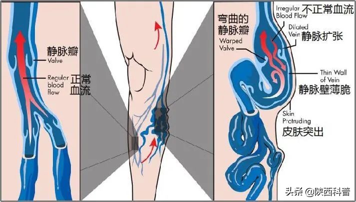 天天科普|跷二郎腿会影响“生育力”？快把腿放下来！