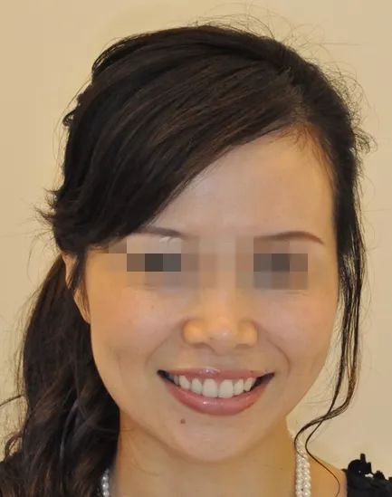 国家有关于牙齿的补贴吗,牙齿补贴报销政策