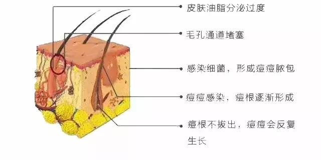 网传芦荟涂脸可以祛痘，是真的吗？千万别再踩坑了