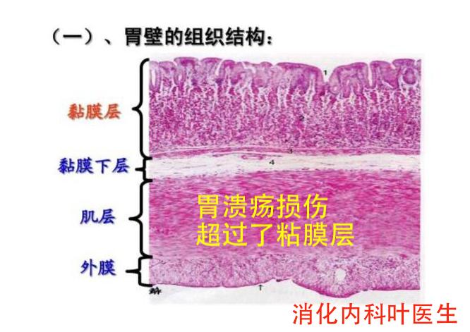 胃镜检查没问题但是一直烧心,胃镜检查没问题但是胃还是胀