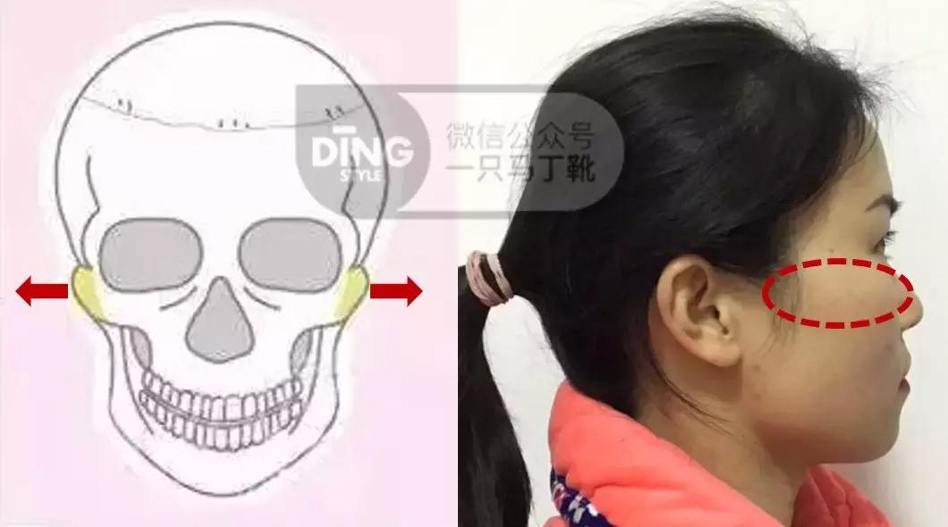 修饰扁头头型的发型,头型不好扁头适合什么发型