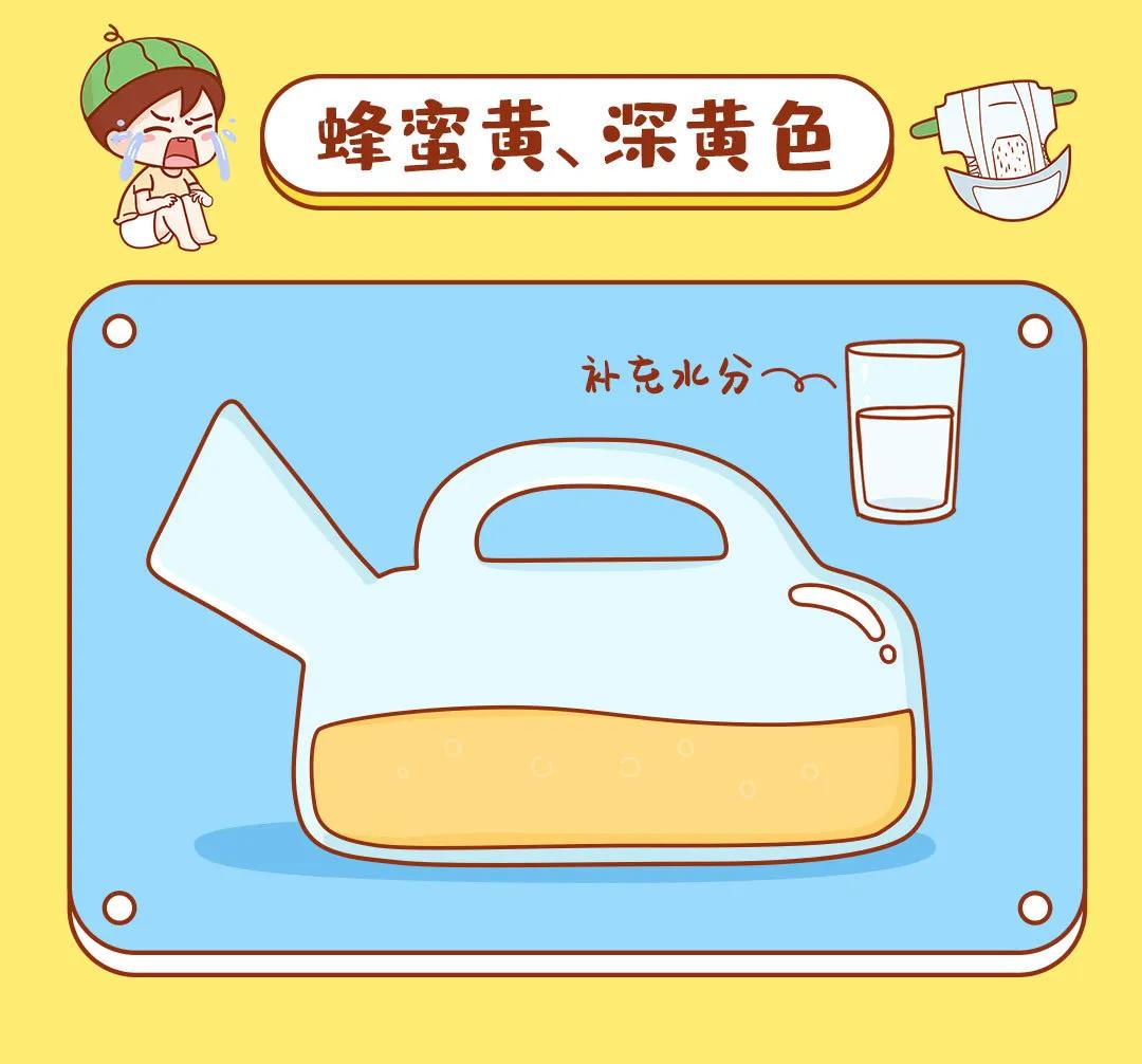 宝宝尿液颜色分析,宝宝尿液全项分析