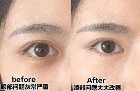 眼霜涂得好真的不显老,眼霜擦与不擦有什么区别