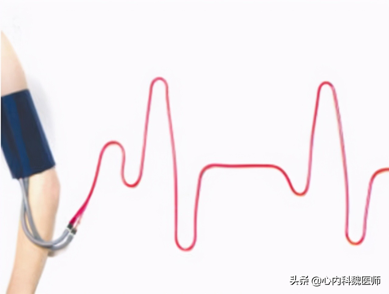 54岁男血压12376,55岁男人血压149低压90