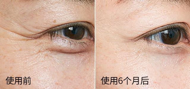 越敷皮肤越嫩的泥膜,没皱纹提拉紧致女神的冻龄神器