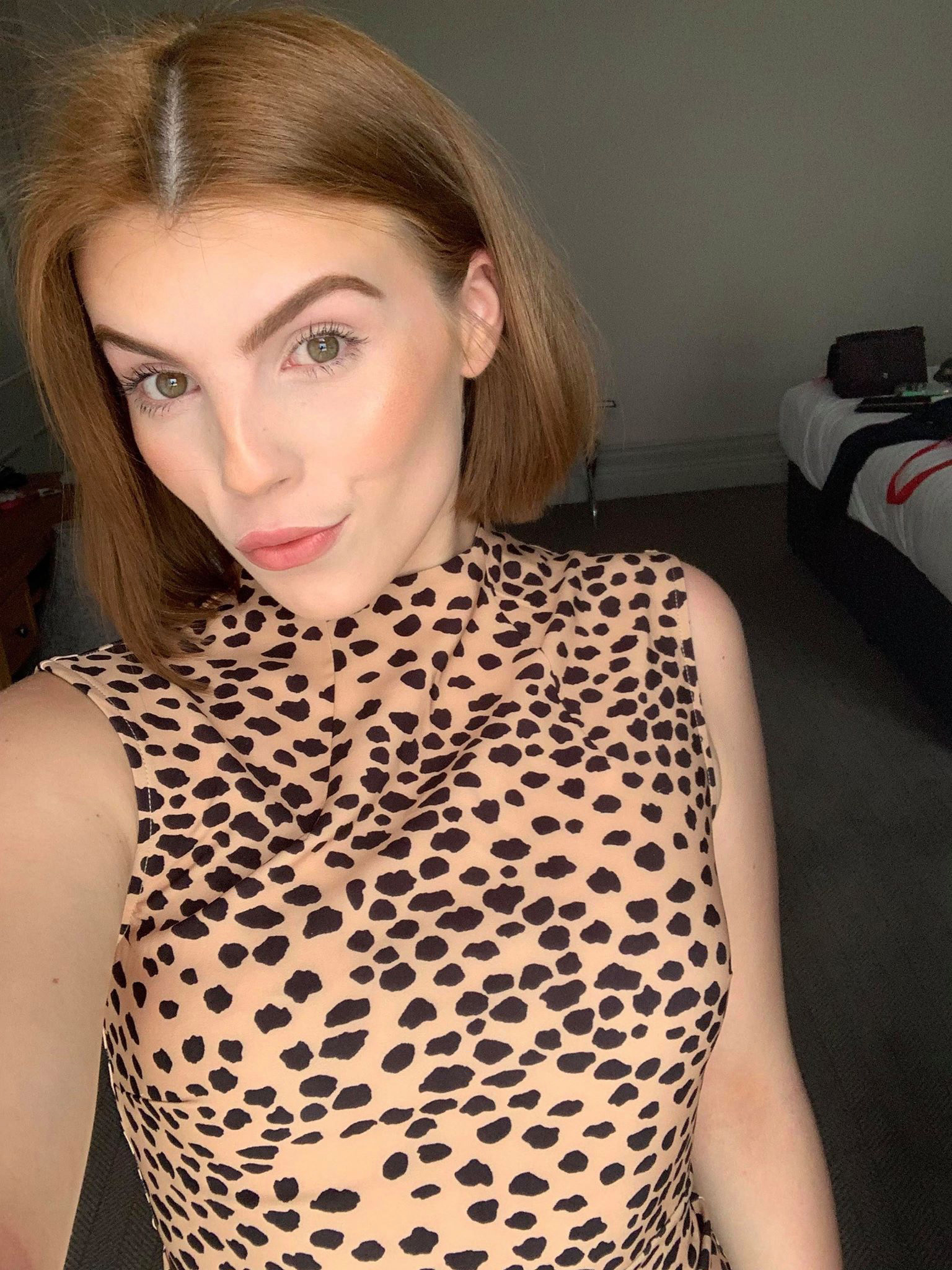 11岁女孩全身长湿疹是怎么回事,33岁女子身上长湿疹一查尽是癌