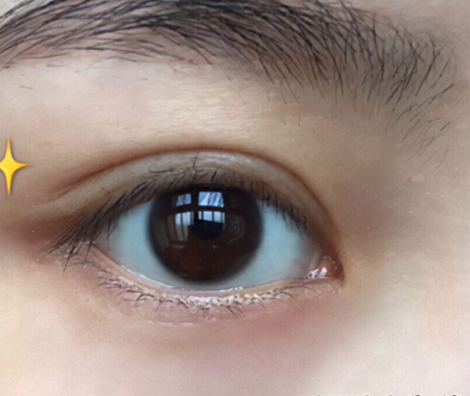 30岁去细纹最好的眼霜排行榜,去眼部皱纹较好的眼霜测评