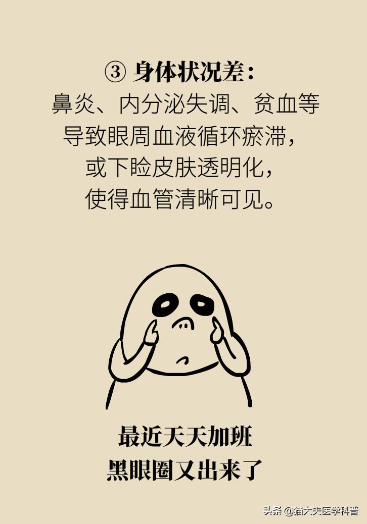 医生黑眼圈,手术消除黑眼圈靠谱吗