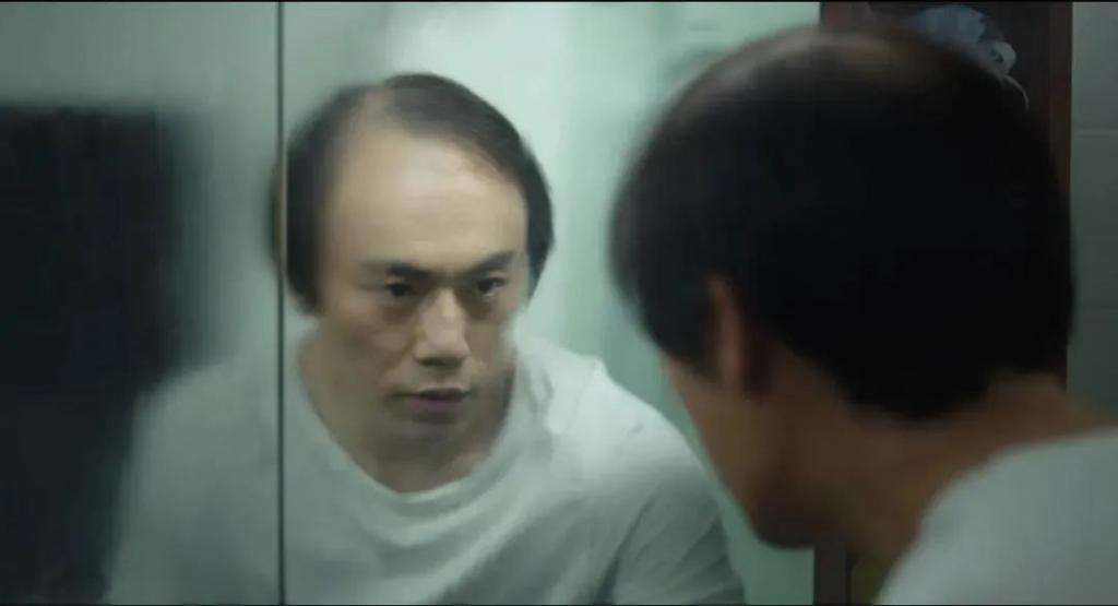 这就挺“秃然”的，揭开男性脱发原因，记得对症下药，挽留秀发