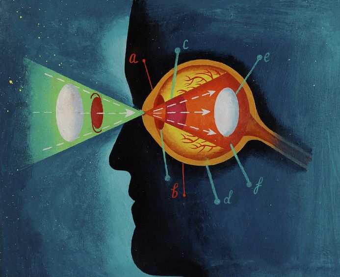 近视600度裸眼视力是几点几,600度近视矫正视力是多少