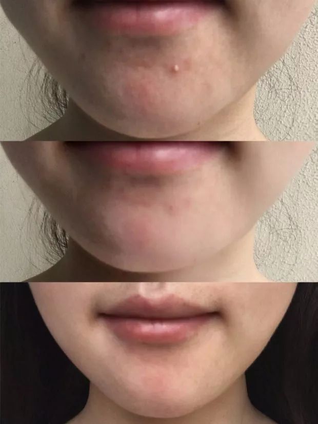 淘宝上的医美面膜是正品吗,可复美医美面膜怎么查真伪