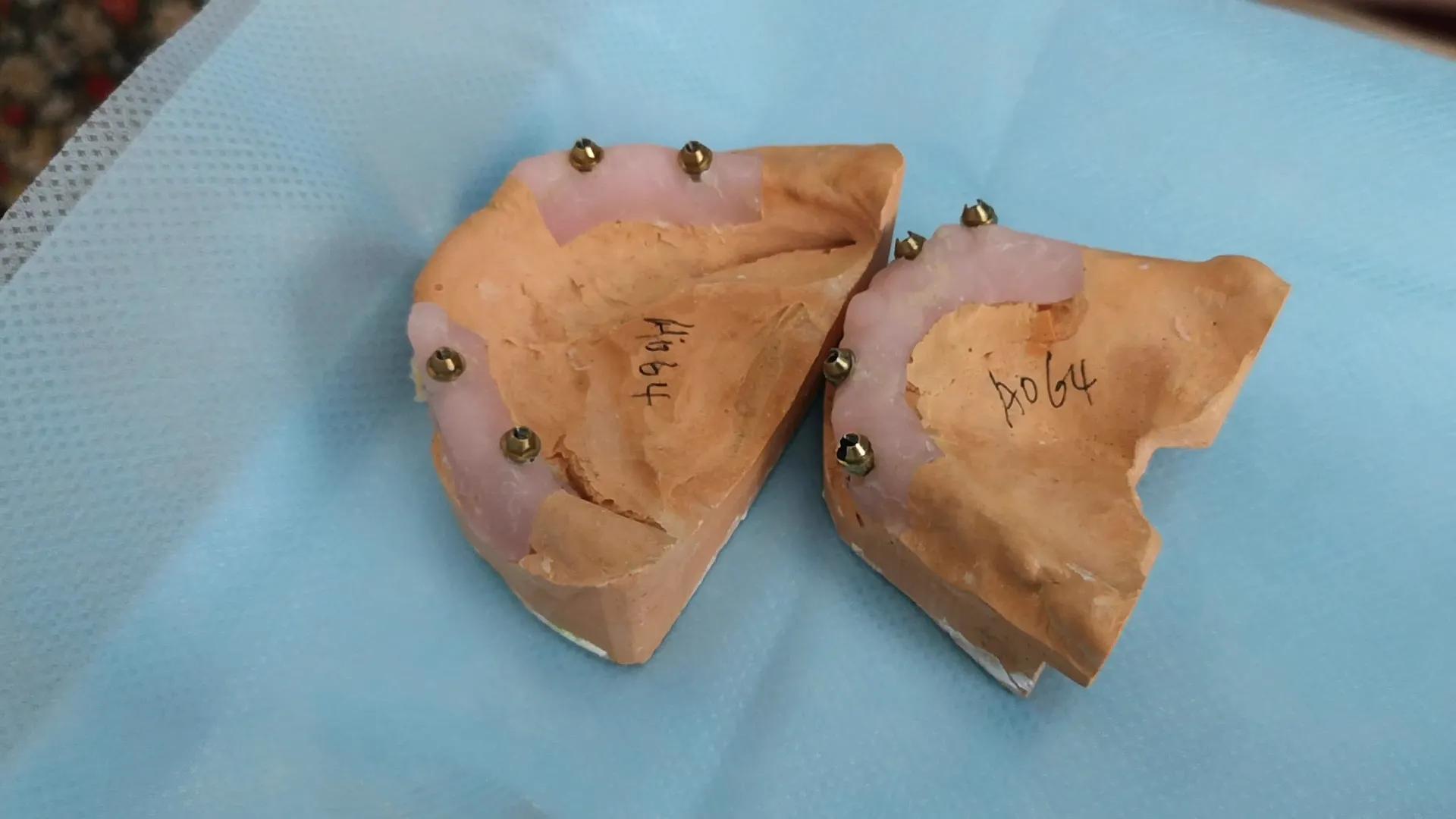 种植全口假牙价格多少,种植上下半口假牙得多少钱视频