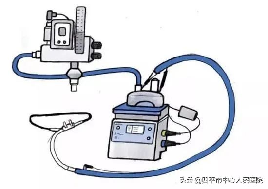 icu中的救命神器,icu里的救命药