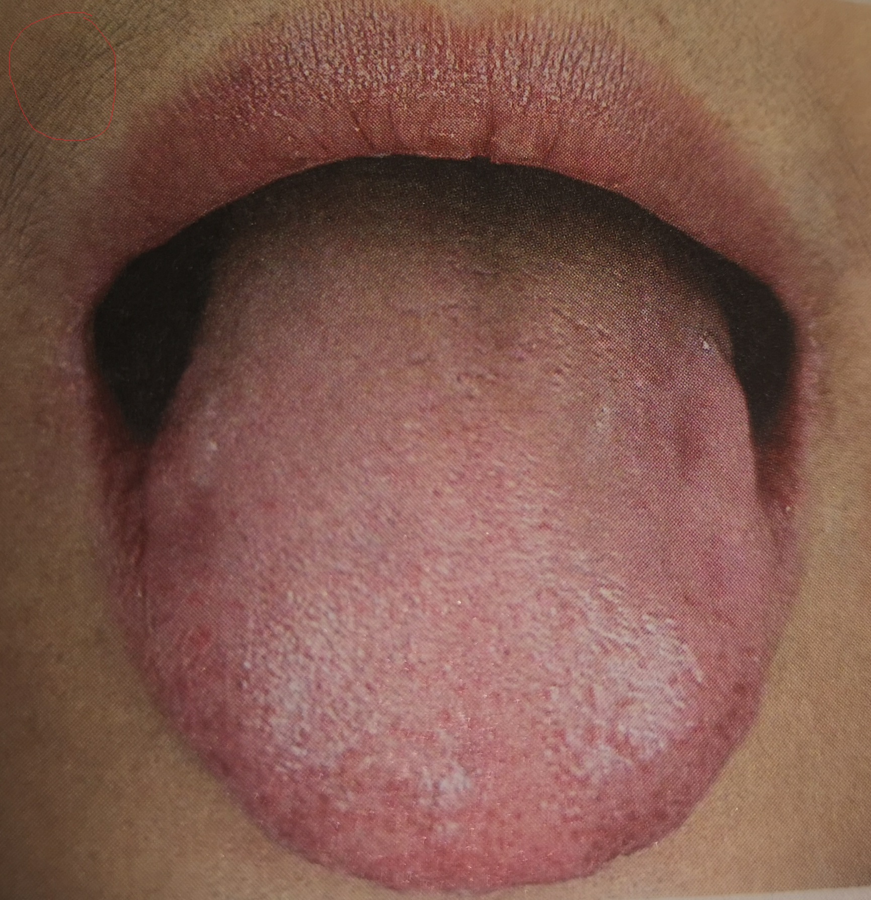 气虚血瘀证和血瘀体质是一回事,血瘀是什么样的图片