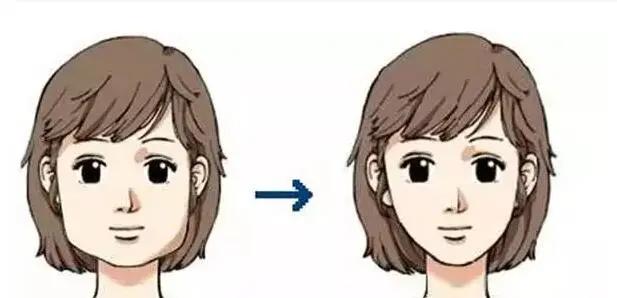 瘦脸针要去什么医院打,想打瘦脸针有什么比较出名的医院