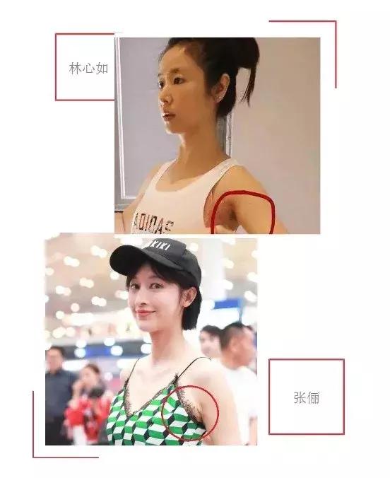 夏天最靠谱的脱毛攻略,脱毛现在最好的技术是