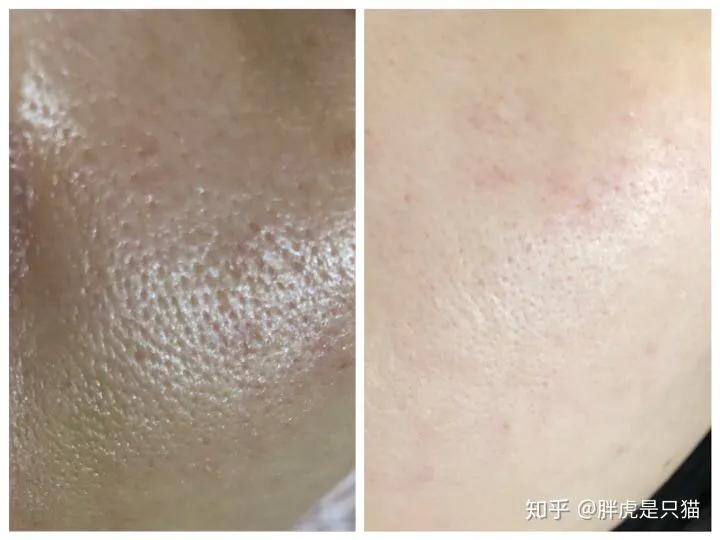 法国护肤品菲洛嘉,菲洛嘉鉴定