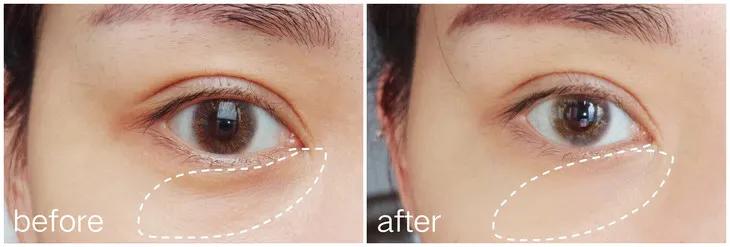 马应龙去除眼纹,马应龙去细纹