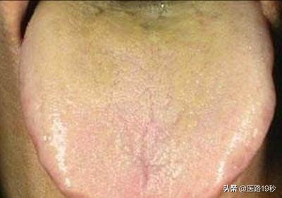 蒲公英茶真的能护肝吗女性,蒲公英菊花决明子茶养肝护肝测评