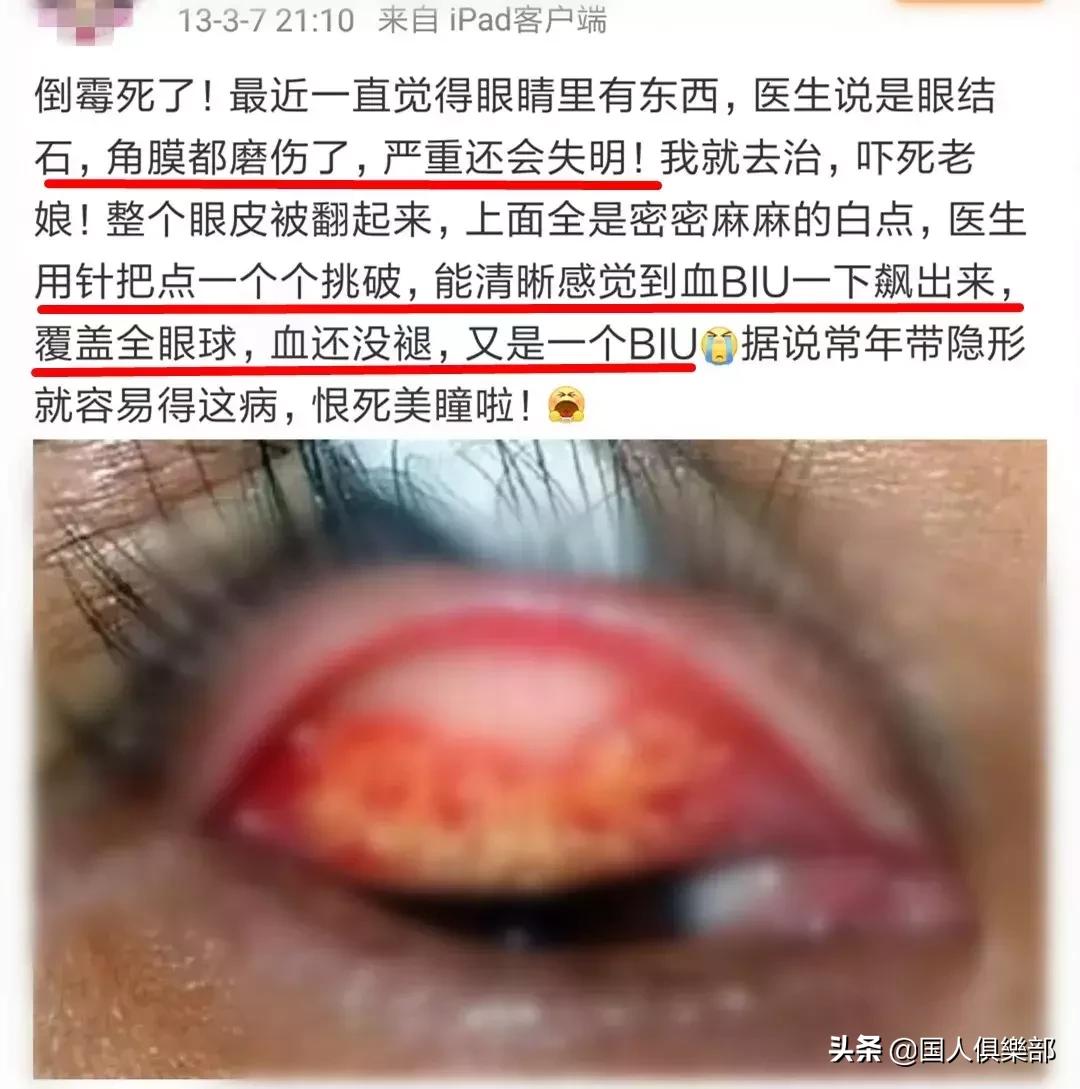 美瞳毁了一个女孩是真的吗,正在被美瞳毁掉的女孩们