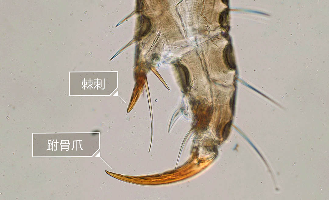 虱子和阴虱样子一样吗,阴虱头虱体虱能用一样的药吗