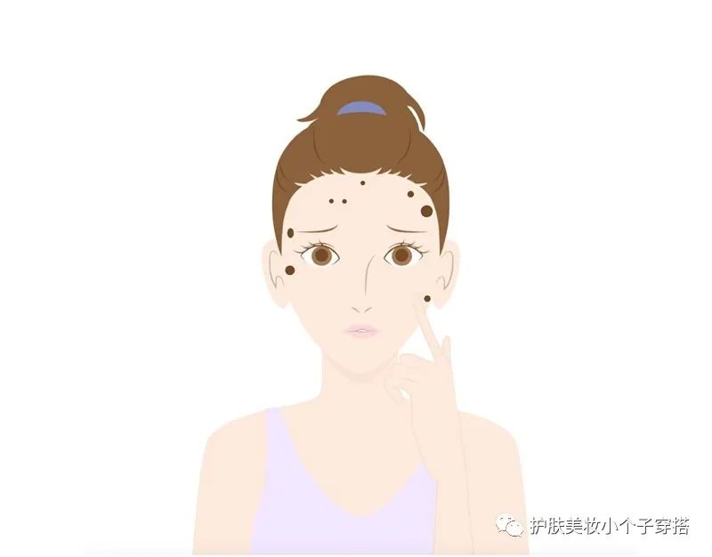 祛斑没有效果不要钱,祛斑没有皮损