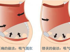 尿失禁怎么办妙招,尿闭禁食禁水吗