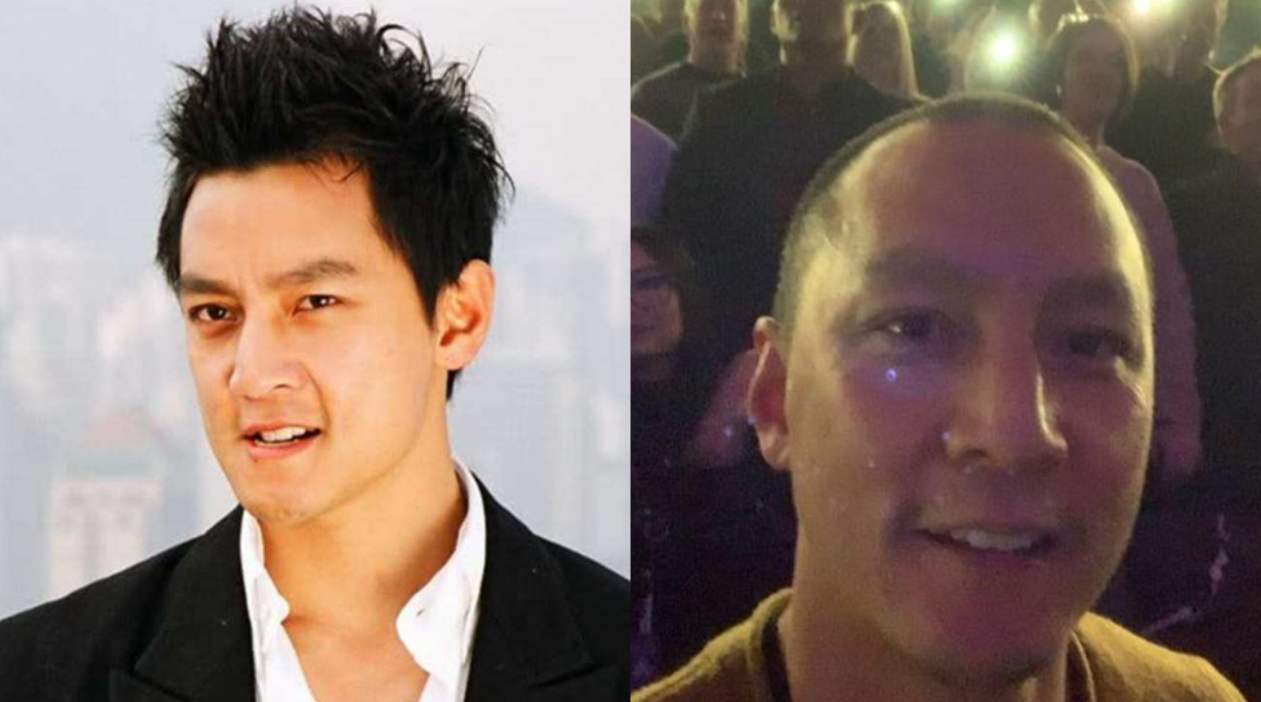 m型脱发也帅的男明星,帅气也挡不住脱发的10位男明星