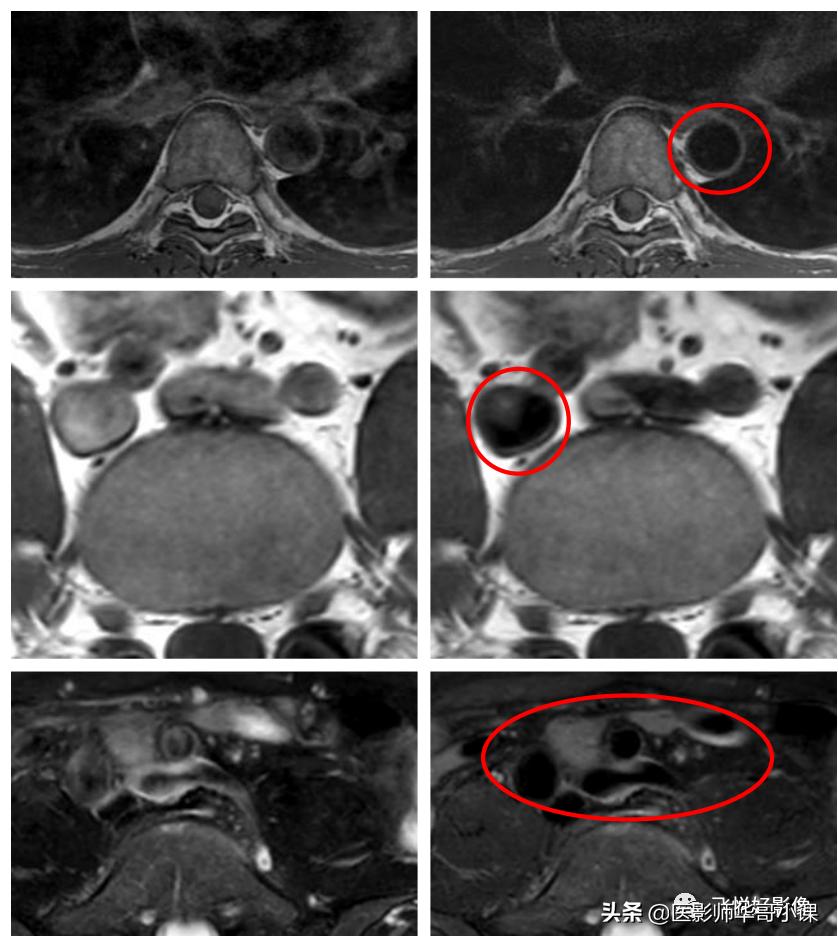 飞利浦磁共振波谱扫描方案,飞利浦1.5t磁共振mri操作使用手册