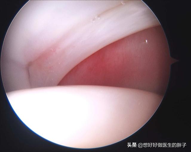 髋关节疼痛两腿不一样长如何康复,左大腿髋关节突然疼痛是什么原因