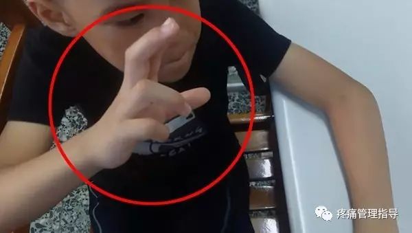 网球肘能自我恢复吗,网球肘病因的解剖学研究