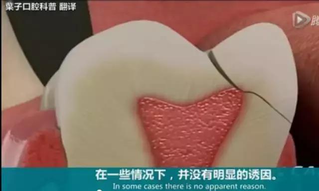 牙龈反复鼓包流脓是牙齿坏了吗,一上火牙龈就鼓包